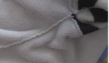 女孩出汗把衣服染蓝查出色汗症 色汗症的具体原因仍不清楚