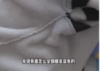 女孩出汗把衣服染蓝查出色汗症 色汗症的具体原因仍不清楚