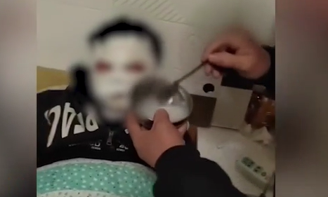 12岁男孩看短视频学做火药被炸伤 只能说好奇害死猫