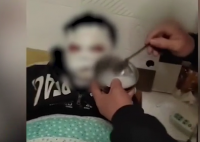 12岁男孩看短视频学做火药被炸伤 只能说好奇害死猫