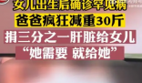 父亲3个月减掉30斤割肝救女 三分之一的肝脏移植给女儿