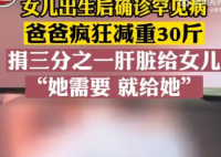 父亲3个月减掉30斤割肝救女 三分之一的肝脏移植给女儿