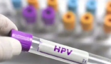 男童喉咙长菜花样肿块确诊感染HPV 肿物呈红色，而且表面不平整