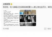 姑娘嗓子疼从就诊到去世仅10分钟 急性会厌炎是什么?