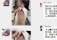 官方通报老师打学生获家长感谢 引发了家长们的不同反应