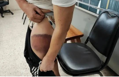 男子在被卖到缅甸途中跳车报警 真是太勇敢了