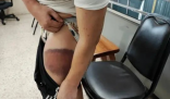 男子在被卖到缅甸途中跳车报警 遭受了电诈团伙的暴力虐待