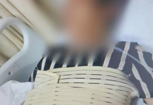 奶奶疑骂孙子被误会遭围殴骨折 是谁对老人下黑手