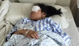 两少年射瞎女童左眼逃离 警方不立案  少年不用负责任？