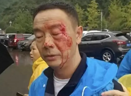 天门山被围殴游客不满处理结果 这起事件涉及到购买商品纠纷和保安人员行为不当