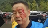 天门山被围殴游客不满处理结果 这起事件涉及到购买商品纠纷和保安人员行为不当