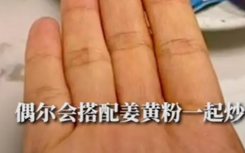 女子为减肥连吃3月胡萝卜变小橘人 呼吁大家树立正确的减肥观念