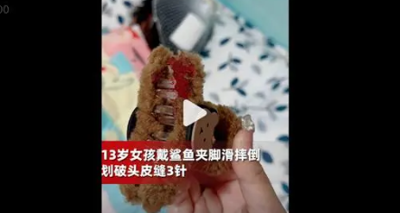 13岁女孩戴鲨鱼夹滑倒头皮缝了3针 引发了广泛的关注和讨