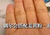 女子为减肥连吃3月胡萝卜变小橘人 呼吁大家树立正确的减肥观念