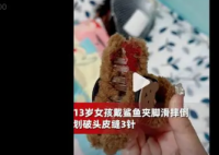 13岁女孩戴鲨鱼夹滑倒头皮缝了3针 让人们对孩子们的安全问题更加关注