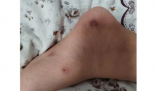 家长称学校无取暖设施孩子手脚冻烂 背后隐藏了什么秘密？