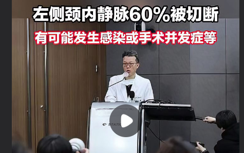 李在明左侧颈内静脉60%被切断 所幸未造成其附近的动脉损伤