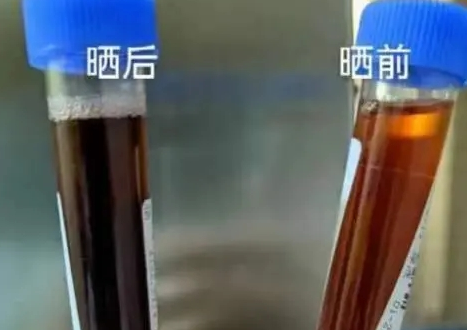 95后女生腹痛难忍口吐“黑水” 这到底是怎么回事？