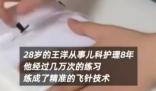 儿科男护士上万次练成精准飞针 练成了精准的飞针技术