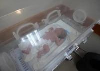 孕妇空袭遇难腹中婴儿被救出 实在太悲剧了