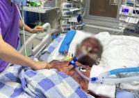 男子带伤切猪肉感染猪链球菌长满瘀斑 实在太恐怖了