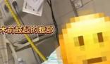 女子便秘20多年差点撑爆肚子 背后真相实在让人惊愕